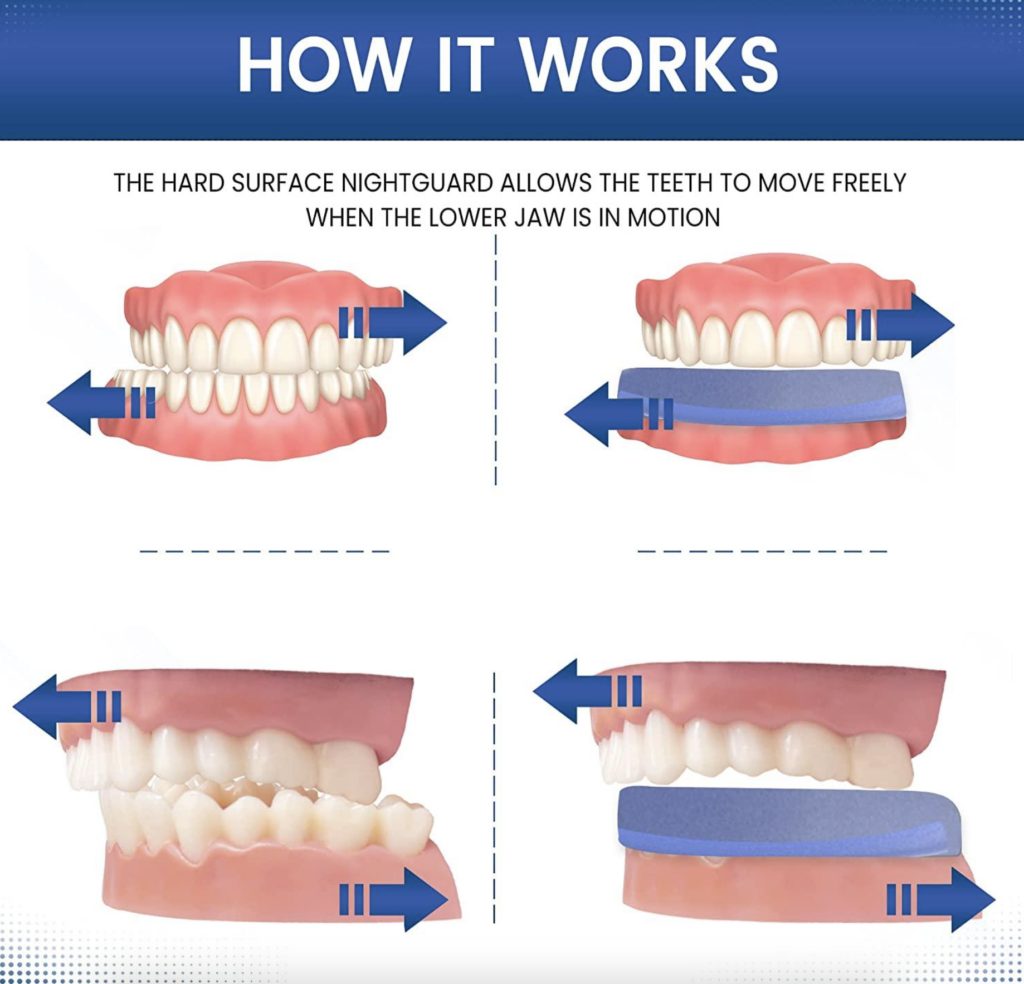 How a Nightguard Protects Your Teeth